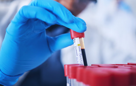 Xét nghiệm chỉ 1 giọt máu có thể dự đoán nguy cơ mắc bệnh sớm 10 năm