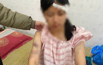 Bắt bà nội và 2 người ông đánh đập dã man cháu gái 13 tuổi