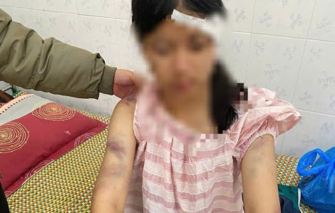 Bắt bà nội và 2 người ông đánh đập dã man cháu gái 13 tuổi