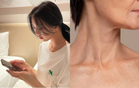 Khi thói quen dùng điện thoại đang hủy hoại làn da