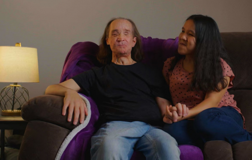 Đằng sau kỳ tích những ca phẫu thuật ghép mặt