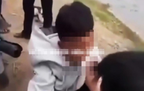 Diễn biến mới vụ nam sinh bị nhét băng vệ sinh vào miệng ở An Giang