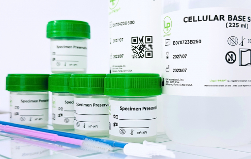 LiquiPrep: Phương pháp tầm soát tiền ung thư cổ tử cung được FDA Mỹ và cộng đồng y tế công nhận