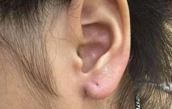 Bé gái 5 tuổi bị người phụ nữ lột bông tai trước cửa nhà