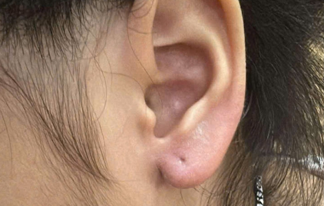 Bé gái 5 tuổi bị người phụ nữ lột bông tai trước cửa nhà