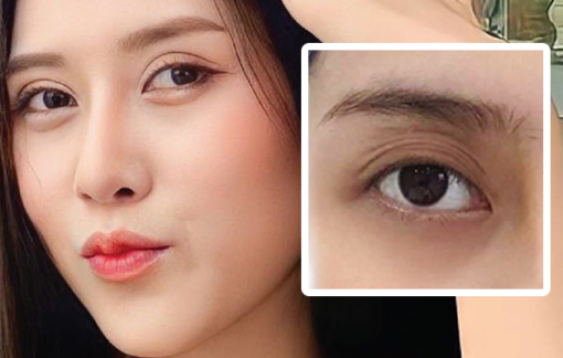 Mắt sâu - hung thần nhan sắc của phái đẹp