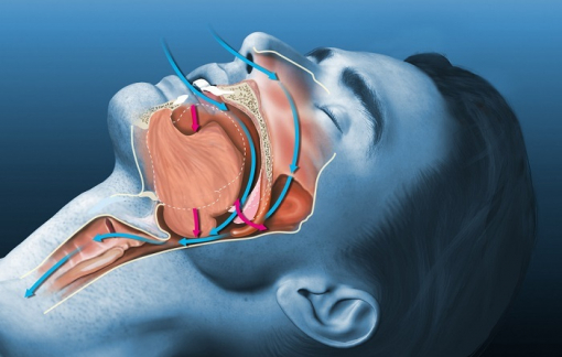 Ngủ ngáy, ngưng thở ngắt quãng khi ngủ làm tăng 92% nguy cơ mắc Parkinson