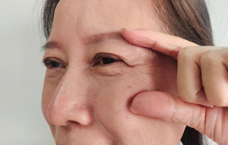 5 dấu hiệu cho thấy da đang mất collagen