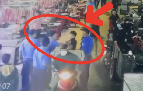 Điều tra nhóm bảo vệ chợ đầu mối Hóc Môn đánh công nhân bốc xếp gãy mũi