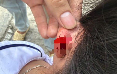 Một giáo viên ở Đặc khu Phú Quốc nhéo tai học sinh vì viết bài sai nhiều lần