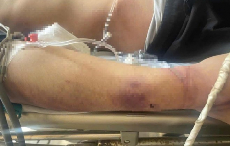 Khi bạo lực len lỏi học đường dưới vỏ bọc hỗ trợ