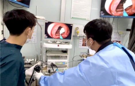 Sụt cân bất thường, người đàn ông phát hiện sán dài gần 1 mét ngọ nguậy trong đại tràng