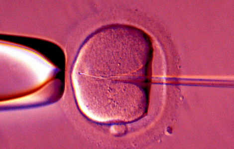 Trứng người được 'trẻ hóa' để nâng cao tỉ lệ thành công IVF