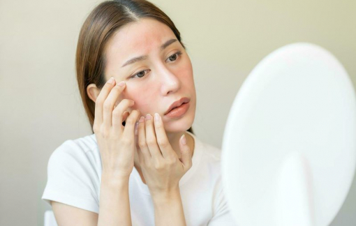 Làm sao để giảm khô ngứa da vào mùa lạnh?