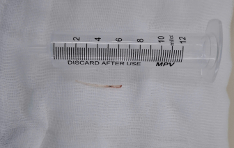 Liên tiếp nhiều người suýt tử vong chỉ vì thói quen nhỏ