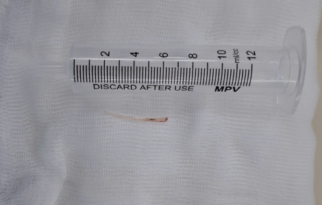 Liên tiếp nhiều người suýt tử vong chỉ vì thói quen nhỏ