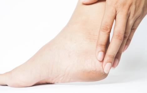 5 cách đơn giản giúp gót chân mềm mịn, tạm biệt nứt nẻ