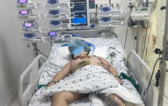 Bé gái 9 tuổi bị lóc da diện rộng sau tai nạn giao thông