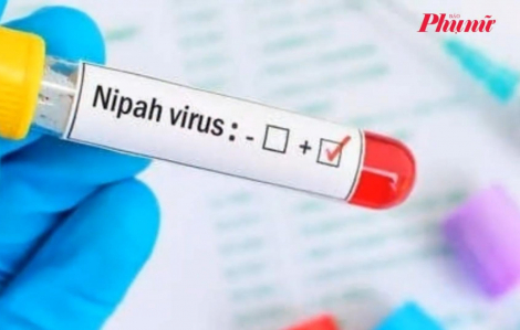 Virus Nipah có tỷ lệ tử vong tới 75%, Bộ Y tế Việt Nam phát cảnh báo khẩn