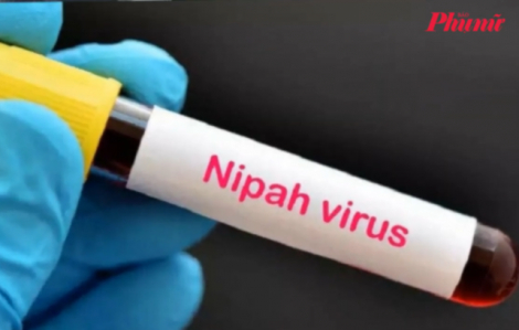 Loại thuốc của Trung Quốc có thể ngăn chặn virus Nipah lây lan?