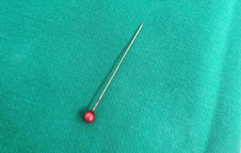 Lý do không ngờ khiến kim ghim vải nằm trong phế quản bé trai 13 tháng tuổi