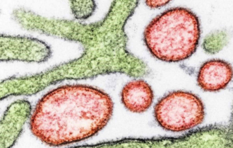 Sắp thử nghiệm vắc xin ngừa vi rút Nipah