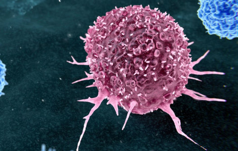 Hơn 1/3 ca ung thư có thể phòng ngừa từ thói quen phổ biến