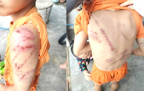 Công an xác minh sự việc bé trai 10 tuổi bị cha ruột bạo hành