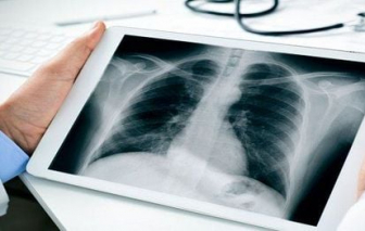 Không lấy thời gian chụp X-quang làm căn cứ để từ chối thanh toán bảo hiểm y tế