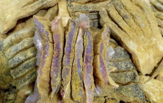 Nhập viện do nghi ngộ độc Botulinum sau khi ăn cá ủ chua