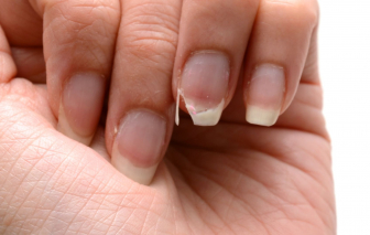 Cách chăm sóc và phục hồi móng tay yếu, dễ gãy