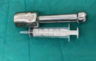 Thiếu niên 15 tuổi mắc kẹt chày kim loại... trong trực tràng