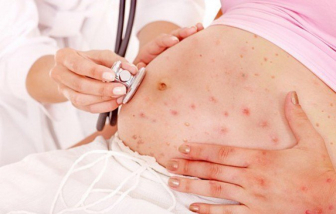 Mang thai 18 tuần, cô giáo mầm non nhập viện vì bị học sinh lây bệnh truyền nhiễm