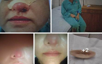 Phạt một cơ sở thẩm mỹ 'chui' 80 triệu đồng, đình chỉ hoạt động 18 tháng