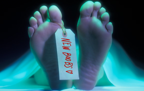 Tiêm 'mỡ từ người chết' - cơn sốt thẩm mỹ gây tranh cãi nhất hiện nay