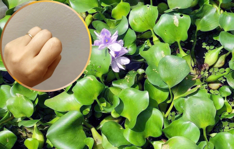 Vết sẹo ngày xưa