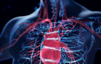 AI có thể “tiên đoán” nguy cơ suy tim trước 5 năm