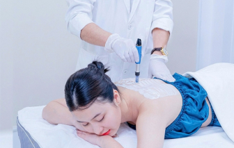 Ứng dụng BioSkin kết hợp công nghệ CNC trong điều trị viêm nang lông