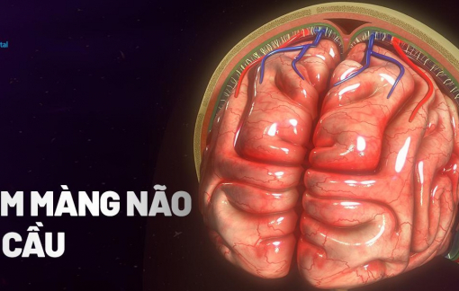 Cà Mau: 3 trường hợp nghi viêm não mô cầu, 1 người đã tử vong