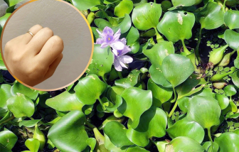 Vết sẹo ngày xưa