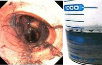 Cứu sống các nạn nhân trong vụ cháy tại phường Tân Thới Hiệp