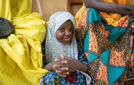 Phát hiện vi khuẩn 'ăn mòn khuôn mặt' của trẻ