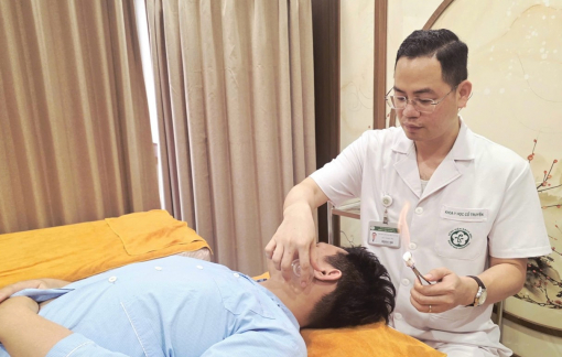 Liệt mặt giữa mùa nóng - chủ quan vì nghĩ bệnh khó xảy ra
