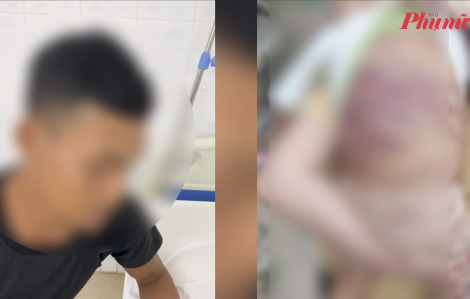 Bắt khẩn cấp người mẹ và nhân tình bạo hành cháu bé 2 tuổi