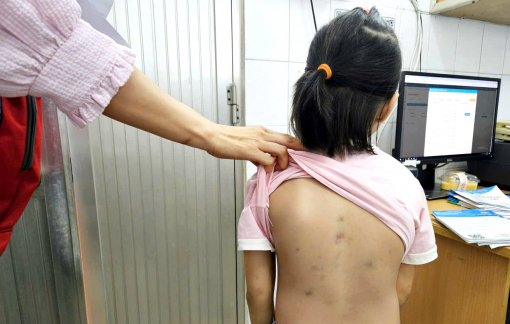 Nắng nóng, chó mèo trở nên hung hãn tấn công người