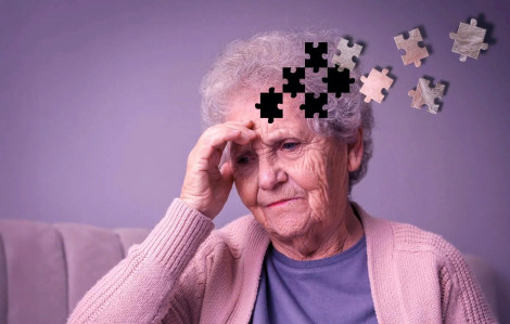 Các nhà khoa học phát hiện lý do phụ nữ có nguy cơ mắc Alzheimer cao
