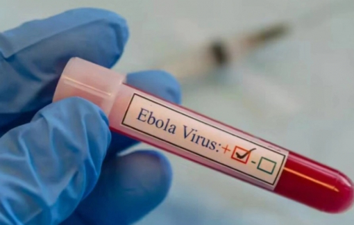 Bộ Y tế yêu cầu cơ sở y tế chủ động phòng, chống dịch Ebola