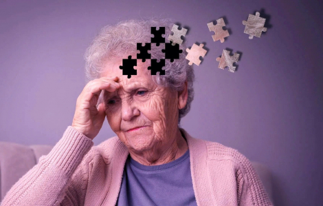 Các nhà khoa học phát hiện lý do phụ nữ có nguy cơ mắc Alzheimer cao