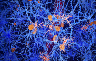 Tái lập trình tế bào não để điều trị Alzheimer