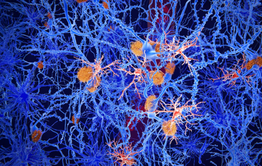 Tái lập trình tế bào não để điều trị Alzheimer